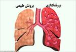 پاورپوینت-درباره-بیماری-آسم
