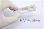 پاورپوینت-آزمایش-های-اچ-آی-وی