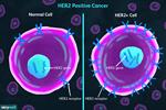 پاورپوینت-اثر-ژن-her2-و-مسیر-nf-kb-درایجاد-سرطان--(انگلیسی)